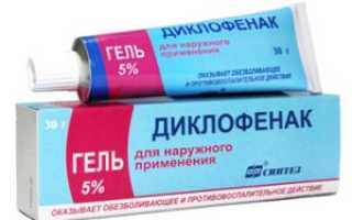 Особенности лечения периартрита коленного сустава