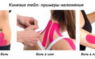 Кинезио тейп — лечебно профилактический пластырь для мышц и суставов