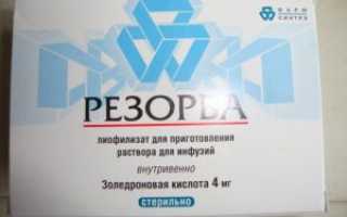 Современный бисфосфонат Резорба в борьбе с разрушением костной ткани