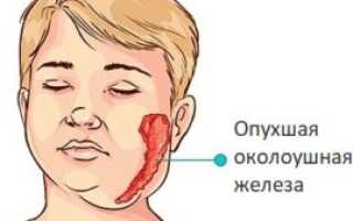 Густая слюна при кандидозе