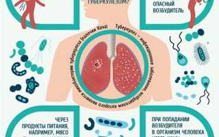 Туберкулез кости симптомы черепа