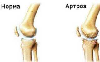 Подробная инструкция с пояснениями к препарату Артроцельс