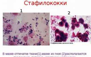Что такое стафилококковые отравления являются