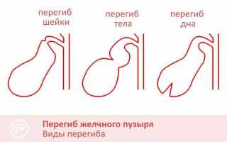 При деформации шейки желчного пузыря появилась чесотка