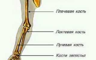 Симптомы, лечение и восстановление после перелома руки