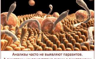 Как организм обезвреживает паразитов