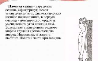 Плоская спина — прямой путь к неврологическим проблемам