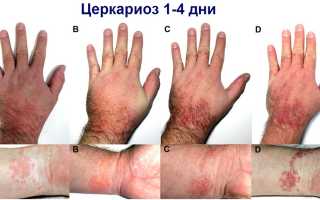 Утиные паразиты в водоеме-чем опасны
