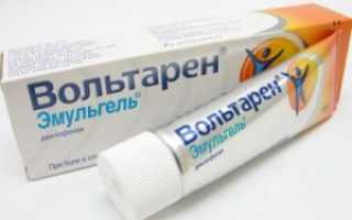 Лучшая мазь от радикулита — отзывы врачей и пациентов