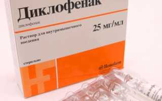 Диклофенак для внутримышечного введения — универсальное средство от болей различной этиологии?