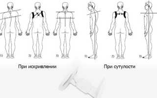 Корректор осанки Chest Belt: ваша спина скажет вам спасибо