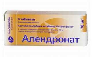 Алендронат: эффективная борьба с разрушением костной ткани