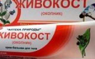 Волшебная сила живокоста, или как помочь своим суставам