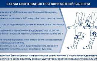 Как выбрать эластичный бинт и правильно пользоваться им