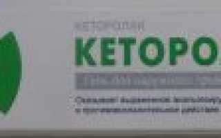 От чего помогает обезболивающее средство Кеторол: инструкция, отзывы