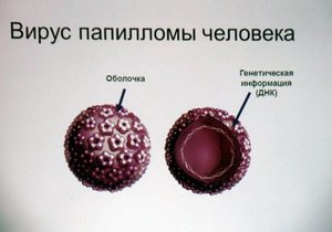 Вирус папилломы человека Что такое ВПЧ