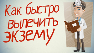 Как лечить экзему - лекарства и народны средства Экзему можно вылечить при помощи лекарственных препаратов и народными средствами.