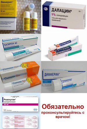 Лечение прыщей с помощью антибиотиков Антибиотики в борьбе с прыщами