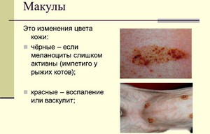 Макулы - это изменения цвета кожи Макулы - что это такое?